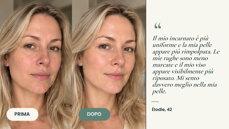Testimonianza prima/dopo — Masque Bio Collagène