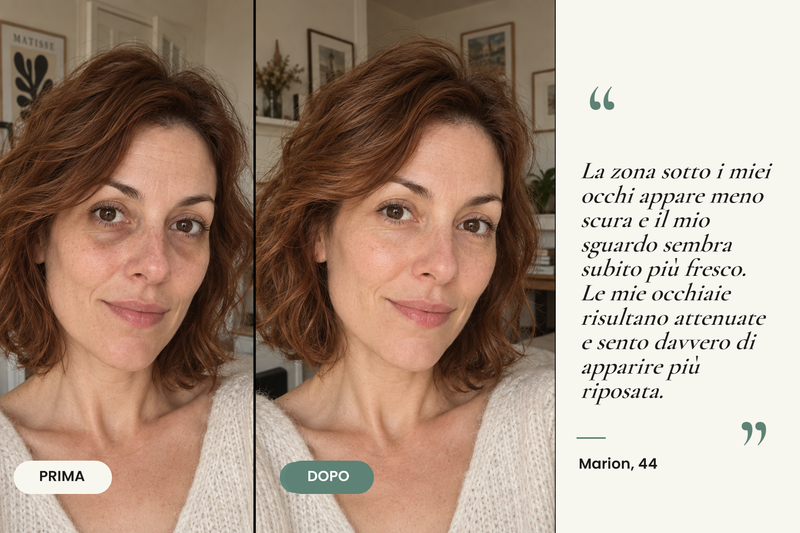 Testimonianza prima/dopo — Patchs Hydrogel Anti-Cernes