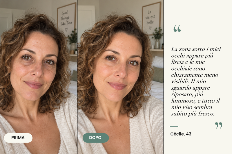 Testimonianza prima/dopo — Patchs Hydrogel Anti-Cernes