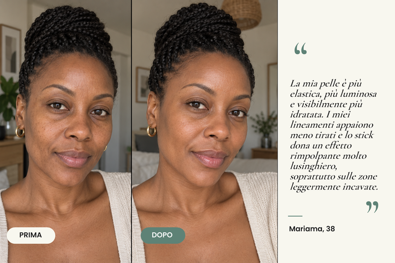 Testimonianza prima/dopo — Stick Repulpant Bio Collagène